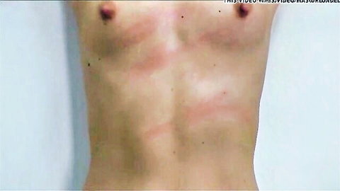 Skinny slavegirl topless with red whip marks on pale chest and abdomen in BDSM