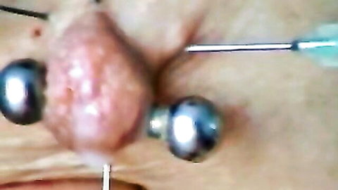 Close-up of swollen pierced pussy labia with metal balls and syringe needle insertion in intense BDSM play