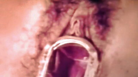 Close-up hairy pussy devoured by kinky doctor's ass and pussy in explicit scene