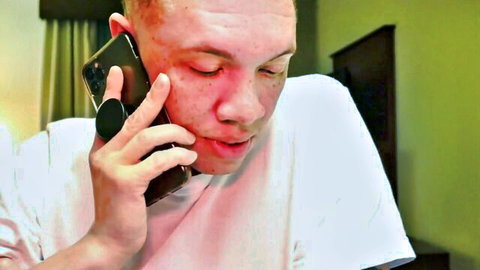 Bald man with bruised swollen bloody face talking on phone in white t-shirt