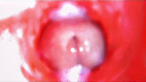 Close-up internal GoPro view of cum-filled pussy after creampie