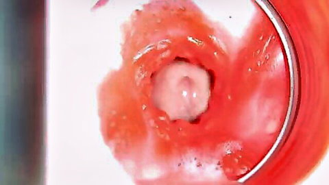 Close-up internal pussy view with big cumshot, 4K ASMR creampie