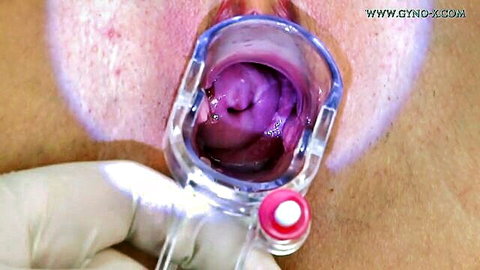 Naomi Nevena in explicit gyno exam with speculum insertion