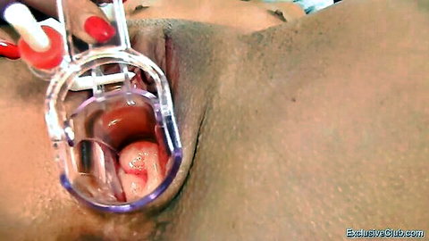 Doctor examines sexy brunette's exposed pussy with speculum closeup