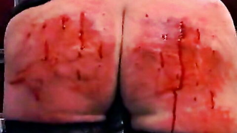 Close-up of woman's large bloody buttocks with scratches from painful torture