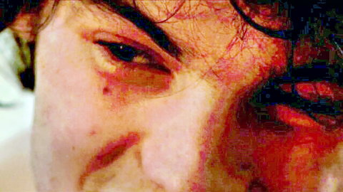 Intense close-up of bruised French man's face in family sexual chronicles