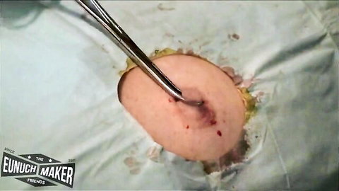 Close-up nipple surgery with clamp and open wound in medical fetish scene