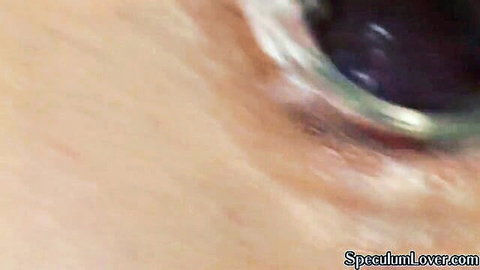 Close-up woman's eye in speculum fetish video thumbnail