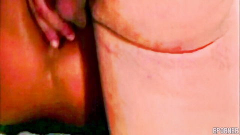 Close-up of nude woman's plump buttocks with visible scar, spicy adult tease