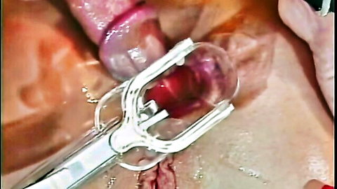 Max Hardcore extreme speculum exam on spread pink pussy
