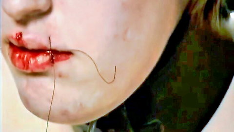 Blonde submissive with bloodied stitched mouth in extreme BDSM session
