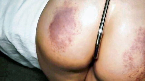 Bruised MILF big ass with metal hook inserted in hardcore anal scene
