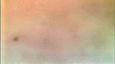 Blurry close-up of skin with spot in French adult video thumbnail