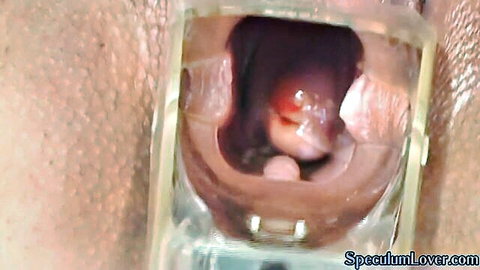 Close-up of babe's spread pussy with speculum inserted