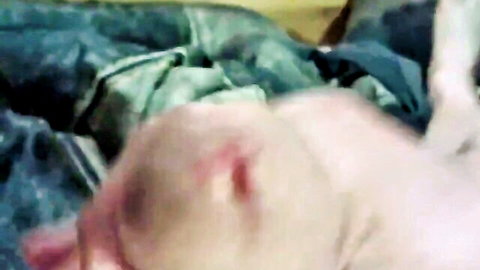 Close-up of bald man's bloody scalp wound on green sheets after rough action