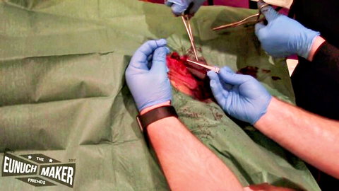 Graphic gay sub castration surgery with gloved hands and bloody incision