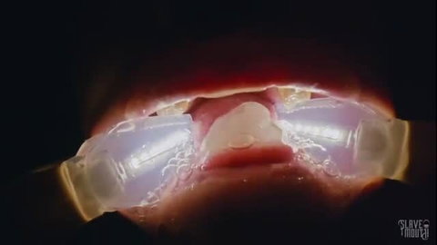 Katie Monroe's wide-open mouth with frozen cum ice trays, filthy closeup