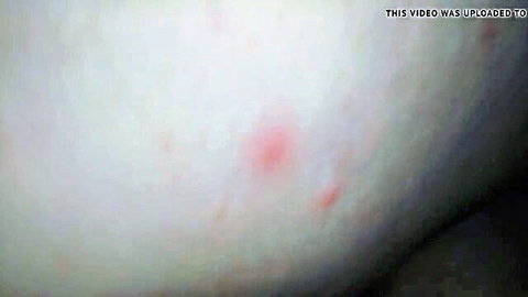 Close-up of pale skin with small red spot and 'THIS VIDEO WAS UPLOADED TO' text overlay.