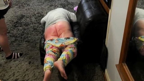 Person face down in pajamas with red marks on bare lower back and buttocks